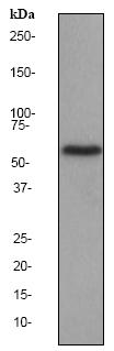 Anti-Catalase antibody [EP1929Y] - Peroxisome Marker (ab76024) at 1/20000 dilution + HeLa cell lysate at 10 µgSecondaryHRP labelled goat anti-rabbit at 1/2000 dilution