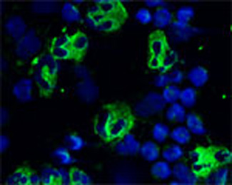 ab64892 staining a cytospin preparation of peripheral blood mononuclear cells isolated from buffycoat. Cells were left to air dry, fixed with cold acetone (90 secs) and blocked in PBS, 1%FCS and 0.1% saponin for 20 mins. Incubation with ab64892 (1/200) was done for 1 hour at room temperature. Cells were washed 2x PBS, incubated with a FITC-labelled secondary antibody, washed in PBS and counterstained with DAPI. ab64892 selectively recognizes polymorphonuclar cells.