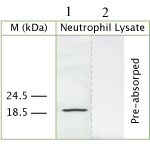 Lane 1 :  Anti-Cathelicidin antibody (ab64892) at 1/100 dilutionLane 2 :  Anti-Cathelicidin antibody (ab64892) at 1/100 dilution (preabsorbed with immunising peptide)Lane 1 : Whole cell lysate prepared from Human neutrophilsLane 2 : Whole cell lysate prepared from Human neutrophils