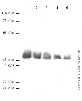 All lanes : Anti-Cathepsin D antibody (ab49789) at 1/1000 dilutionLane 1 : r-Human Cathepsin D at 0.04 µgLane 2 : r-Human Cathepsin D at 0.02 µgLane 3 : r-Human Cathepsin D at 0.01 µgLane 4 : r-Human Cathepsin D at 0.004 µgLane 5 : r-Human Cathepsin D at 0.002 µg