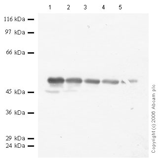 All lanes : Anti-Cathepsin E antibody (ab49798) at 1/1000 dilutionLane 1 : Recombinant Human Cathepsin E at 0.04 µgLane 2 : Recombinant Human Cathepsin E at 0.02 µgLane 3 : Recombinant Human Cathepsin E at 0.01 µgLane 4 : Recombinant Human Cathepsin E at 0.004 µgLane 5 : Recombinant Human Cathepsin E at 0.002 µg