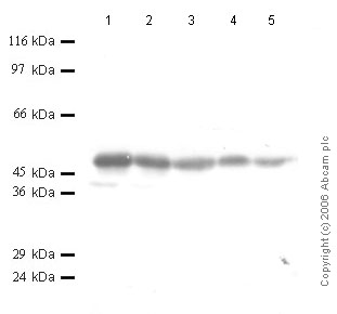 All lanes : Anti-Cathepsin E antibody (ab49800) at 1/1000 dilutionLane 1 : r-Human Cathepsin E at 0.04 µgLane 2 : r-Human Cathepsin E at 0.02 µgLane 3 : r-Human Cathepsin E at 0.01 µgLane 4 : r-Human Cathepsin E at 0.004 µgLane 5 : r-Human Cathepsin E at 0.002 µg