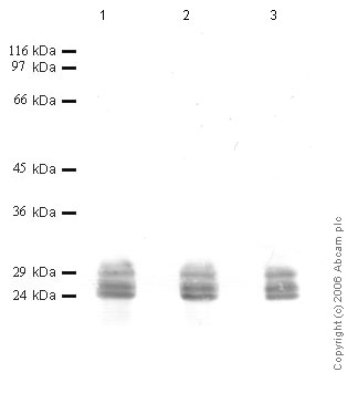 All lanes : Anti-Cathepsin G antibody (ab49854) at 1/1000 dilutionLane 1 : Human Cathepsin G at 0.01 µgLane 2 : Human Cathepsin G at 0.005 µgLane 3 : Human Cathepsin G at 0.002 µg
