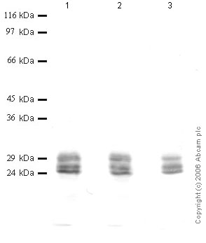 All lanes : Anti-Cathepsin G antibody (ab49856) at 1/1000 dilutionLane 1 : r-Human Cathepsin G at 0.01 µgLane 2 : r-Human Cathepsin G at 0.005 µgLane 3 : r-Human Cathepsin G at 0.002 µg