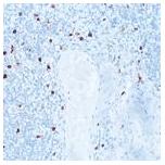 Immunohistochemical staining for Cathepsin G using ab50845 (1/100 dilution) in tonsil tissue. Note intense membrane staining of polymorphonuclear leukocytes. Paraffin section.
