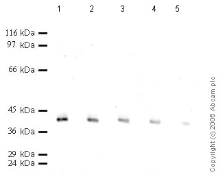All lanes : Anti-Cathepsin H antibody (ab50071) at 1/1000 dilutionLane 1 : Recombinant Human cathepsin H at 0.04 µgLane 2 : Recombinant Human cathepsin H at 0.02 µgLane 3 : Recombinant Human cathepsin H at 0.01 µgLane 4 : Recombinant Human cathepsin H at 0.004 µgLane 5 : Recombinant Human cathepsin H at 0.002 µg