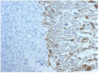 Bone from mouse foot (bone marrow with osteoclasts (positive). IHC-P image was obtained after deparaffinization, antigen retrieval with 0.1 M EDTA (6-8 min, 72 C), drying of slide before staining (10 min, 62 C), and subsequent staining with primary antibody (1/100) in 1% horse serum (1 h, 37 C).