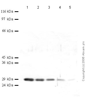 All lanes : Anti-Cathepsin K antibody - Catalytic domain (ab49893) at 1/1000 dilutionLane 1 : r-Human Cathepsin K at 0.04 µgLane 2 : r-Human Cathepsin K at 0.02 µgLane 3 : r-Human Cathepsin K at 0.01 µgLane 4 : r-Human Cathepsin K at 0.004 µgLane 5 : r-Human Cathepsin K at 0.002 µg