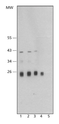 Lane 1 :  Anti-Cathepsin L antibody [CPL33/1] (ab62710) at 1 µg/mlLane 2 :  Anti-Cathepsin L antibody [CPL33/1] (ab62710) at 0.5 µg/mlLane 3 :  Anti-Cathepsin L antibody [CPL33/1] (ab62710) at 0.25 µg/mlLane 4 :  Anti-Cathepsin L antibody [CPL33/1] (ab62710) at 0.12 µg/mlLane 5 :  Anti-Cathepsin L antibody [CPL33/1] (ab62710)Lane 1 : Equal amounts of total cell extract of A549 cells (ab7910)Lane 2 : Equal amounts of total cell extract of A549 cells (ab7910)Lane 3 : Equal amounts of total cell extract of A549 cells (ab7910)Lane 4 : Equal amounts of total cell extract of A549 cells (ab7910)Lane 5 : Equal amounts of total cell extract of A549 cells (ab7910) with CPL33/1 peptide