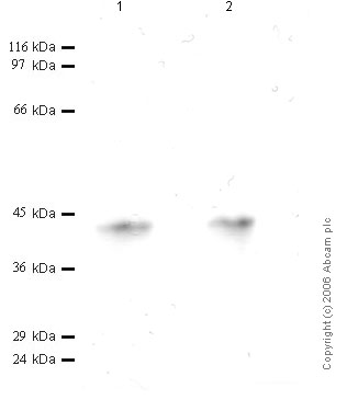 All lanes : Anti-Cathepsin L antibody - 2nd extracellular domain (ab49983) at 1/1000 dilutionLane 1 : Sw1353 CM Serum FreeLane 2 : Sw1353 CM treated with TPA