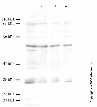 All lanes : Anti-Cathepsin O antibody (ab50527) at 1/1000 dilutionLane 1 : Whole cell lysate prepared from Madin Darby canine kidney (MDCK) cells (treated with TNF-alpha) at 15 µlLane 2 : Whole cell lysate prepared from Madin Darby canine kidney (MDCK) cells (treated with TNF-alpha) at 10 µlLane 3 : Whole cell lysate prepared from Madin Darby canine kidney (MDCK) cells (treated with TNF-alpha) at 8 µlLane 4 : Whole cell lysate prepared from Madin Darby canine kidney (MDCK) cells (treated with TNF-alpha) at 5 µl