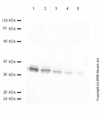 All lanes : Anti-Cathepsin S antibody (ab50399) at 1/1000 dilutionLane 1 : Recombinant Human Cathepsin S at 0.04 µgLane 2 : Recombinant Human Cathepsin S at 0.02 µgLane 3 : Recombinant Human Cathepsin S at 0.01 µgLane 4 : Recombinant Human Cathepsin S at 0.004 µgLane 5 : Recombinant Human Cathepsin S at 0.002 µg