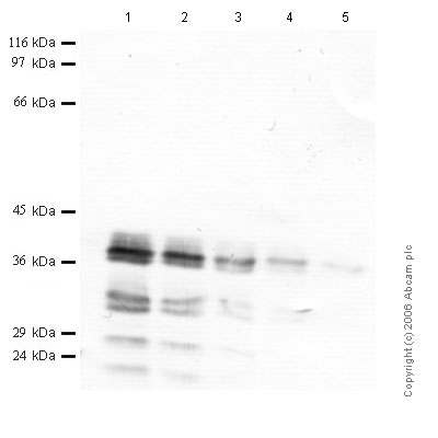 All lanes : Anti-Cathepsin S antibody - Catalytic domain (ab50400) at 1/1000 dilutionLane 1 : r-Human Cathepsin S at 0.04 µgLane 2 : r-Human Cathepsin S at 0.02 µgLane 3 : r-Human Cathepsin S at 0.01 µgLane 4 : r-Human Cathepsin S at 0.004 µgLane 5 : r-Human Cathepsin S at 0.002 µg