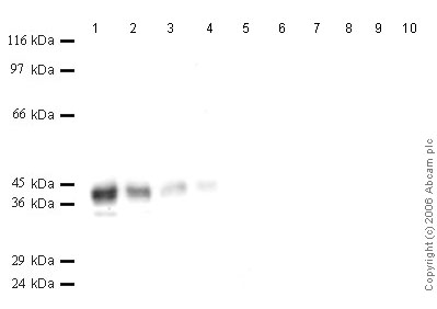 All lanes : Anti-Cathepsin V antibody (ab49981) at 1/1000 dilutionLane 1 : r-Human Cathepsin V at 0.04 µgLane 2 : r-Human Cathepsin V at 0.02 µgLane 3 : r-Human Cathepsin V at 0.01 µgLane 4 : r-Human Cathepsin V at 0.004 µgLane 5 : r-Human Cathepsin V at 0.002 µgLane 6 : r-Human Cathepsin L at 0.04 µgLane 7 : r-Human Cathepsin L at 0.02 µgLane 8 : r-Human Cathepsin L at 0.01 µgLane 9 : r-Human Cathepsin L at 0.004 µgLane 10 : r-Human Cathepsin L at 0.002 µg