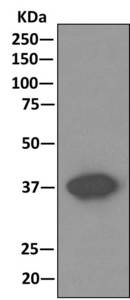 Western blot analysis on immunoprecipitation pellet from Human small intestine lysate, using ab166894 at 1/1000 and HRP-conjugated anti-rabbit IgG, preferentially detecting the non-reduced form of rabbit IgG.