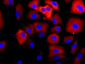 Immunofluorescent analysis of A549 cells labeling Cathepsin V with ab166894 at 1/250 dilution.