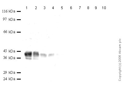 All lanes : Anti-Cathepsin V antibody - Catalytic domain (ab49982) at 1/1000 dilutionLane 1 : r-Human Cathepsin V at 0.04 µgLane 2 : r-Human Cathepsin V at 0.02 µgLane 3 : r-Human Cathepsin V at 0.01 µgLane 4 : r-Human Cathepsin V at 0.004 µgLane 5 : r-Human Cathepsin V at 0.002 µgLane 6 : r-Human Cathepsin L at 0.04 µgLane 7 : r-Human Cathepsin L at 0.02 µgLane 8 : r-Human Cathepsin L at 0.01 µgLane 9 : r-Human Cathepsin L at 0.004 µgLane 10 : r-Human Cathepsin L at 0.002 µg