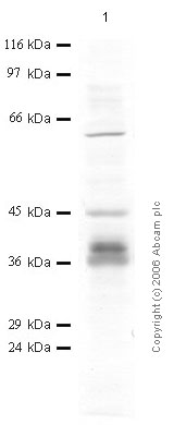 Anti-Cathepsin W antibody (ab50551) at 1/1000 dilution + A2058 human melanoma cancer cell lysate