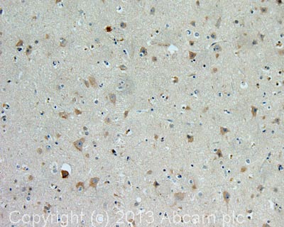 IHC image of CaV1.3 staining in human cerebral cortex formalin fixed paraffin embedded tissue section, performed on a Leica Bond system using the standard protocol F. The section was pre-treated using heat mediated antigen retrieval with sodium citrate buffer (pH6, epitope retrieval solution 1) for 20 mins. The section was then incubated with ab81096, 5µg/ml, for 15 mins at room temperature and detected using an HRP conjugated compact polymer system. DAB was used as the chromogen. The section was then counterstained with haematoxylin and mounted with DPX.For other IHC staining systems (automated and non-automated) customers should optimize variable parameters such as antigen retrieval conditions, primary antibody concentration and antibody incubation times.