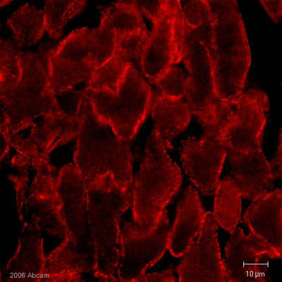 Mouse heart tissue sections stained for caveolin-3. Primary ab used was ab2912 and secondary was an anti-rabbit goat polyclonal antibody conjugated to Cy3.See Abreview