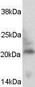 Western blot of caveolin-3 on rat cardiac muscle protein extract using ab2912. Western blot of caveolin-3 on rat cardiac muscle protein extract using ab2912.