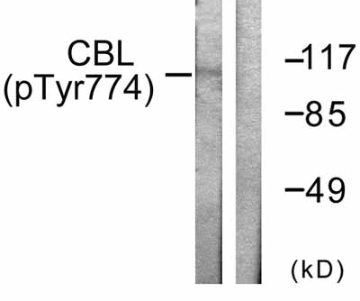 All lanes : Anti-CBL (phospho Y674) antibody (ab58508) at 1/500 dilutionLane 1 : Extracts from HepG2 cells, treated with Na2VO3 (0.3nM, 40mins)Lane 2 : Extracts from HepG2 cells, treated with Na2VO3 (0.3nM, 40mins), plus immunising peptide