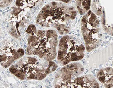 Image courtesy of Human Protein Atlas ab34750 (1/500) showing strong nuclear and cytoplasmic stainning of cells of the kidney tubuli. Paraffin embedded human kidney tissue was incubated with ab123 (1/500 dilution) for 30 mins at room temperature. Antigen retrieval was performed by heat induction in citrate buffer pH 6.