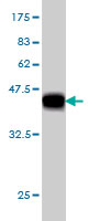 Western blot against tagged recombinant protein immunogen using ab57749 CBLL1 antibody at 1ug/ml.