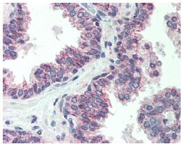 ab64184 (10ug/ml) staining human CBLN1 in human prostate tissue by immunohistochemistry using formalin-fixed, paraffin-embedded tissue.
