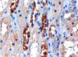 Ab4148 (3ug/ml) staining human CBR1 in human kidney by immunohistochemistry using paraffin embedded tissue. Microwaved antigen retrieval with citrate buffer pH 6, HRP-staining.
