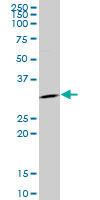 Anti-14-3-3 sigma antibody (ab89405) at 5 µg/ml + Human ovary cancer tissue lysate at 50 µg