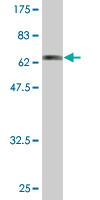 Anti-Actin Regulatory Protein CAPG antibody (ab89511) at 1/500 dilution + Tagged recombinant Human Actin Regulatory Protein CAPG at 0.2 µg