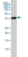 Anti-Actin Regulatory Protein CAPG antibody (ab89511) at 1/500 dilution + HL-60 cell lysate at 50 µg