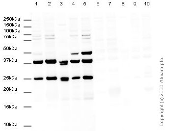 All lanes : Anti-CBX1 / HP1 beta antibody (ab10478) at 1 µg/mlLane 1 : HeLa whole cell lysateLane 2 : HeLa nuclear lysateLane 3 : A431 cell lysateLane 4 : MCF7 cell lysateLane 5 : HEK293 cell lysateLane 6 : HeLa whole cell lysate with CBX1 / HP1 beta peptide (ab30861) at 1 µg/mlLane 7 : HeLa nuclear lysate with CBX1 / HP1 beta peptide (ab30861) at 1 µg/mlLane 8 : A431 lysate with CBX1 / HP1 beta peptide (ab30861) at 1 µg/mlLane 9 : MCF7 cell lysate with CBX1 / HP1 beta peptide (ab30861) at 1 µg/mlLane 10 : HEK293 cell lysate with CBX1 / HP1 beta peptide (ab30861) at 1 µg/mlLysates/proteins at 20 µg per lane.SecondaryGoat Anti-Rabbit IgG H&L (HRP) (ab6721) at 1/5000 dilution