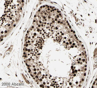 Image courtesy of Human Protein Atlas ab10478 staining CBX1 / HP1 in human testis, showing a distinct and strong staining pattern in ductus seminiferus cells. Paraffin embedded human skin tissue was incubated with ab10478 (1/400 dilution) for 30 mins at room temperature. Antigen retrieval was performed by heat induction in citrate buffer pH 6.  ab10478 was tested in a tissue microarray (TMA) containing a wide range of normal and cancer tissues as well as a cell microarray consisting of a range of commonly used, well characterised human cell lines. Further results for this antibody can be found at www.proteinatlas.org.