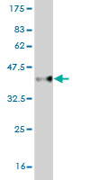 Western blot against tagged recombinant protein immunogen using ab57890 cbx2 antibody at 1ug/ml.