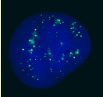 Immunofluorescent imaging of human cells (U2OS) with ab4189 reveals the expected discrete nuclear structure that is termed the PcG body corresponding to the known localisation of PC2. This corresponds to results seen in Satijn et al.IF was performed with a standard paraformaldehyde technique (fixed in PBS buffered PFH 4% for 5 minutes, permeabilised with 0.5% triton-PBS for 5 minutes, blocked with 5% milk / 0.2% tween for one hour.  Primary antibody used at 1/200 in 5% milk / 0.2% TWEEN for one hour, secondary antibody for 30 minutes.  All blocking and incubation steps carried out at 37 degrees C. Nuclei counterstained with Hoechst stain (blue).