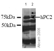 All lanes : Anti-CBX4 antibody (ab4189)Lane 1 : HEK 293 lysate over-expressing DDDDK tagged hPC2 Lane 2 : HEK 293 lysate