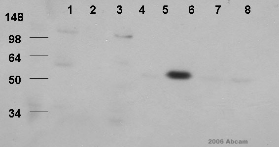 All lanes : Anti-CBX6 + CBX8 antibody (ab24332)Lane 1 : 293Lane 2 : 293 stably expressing cbx6Lane 3 : 293 stably expressing cbx7Lane 4 : 293 stably expressing cbx8Lane 5 : 293Lane 6 : 293 stably expressing cbx6Lane 7 : 293 stably expressing cbx7Lane 8 : 293 stably expressing cbx8SecondaryNon Abcam, antigoat.
