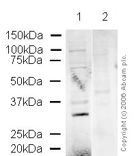 All lanes : Anti-cbx7 antibody (ab31765) at 1 µg/mlLane 1 : Hela nuclear LysateLane 2 : Hela nuclear Lysate with Human cbx7 peptide (ab22423) at 1 µg/mlLysates/proteins at 20 µg per lane.SecondarySecondary ab: Alexa Fluor Goat polyclonal to Rabbit IgG (700) 
