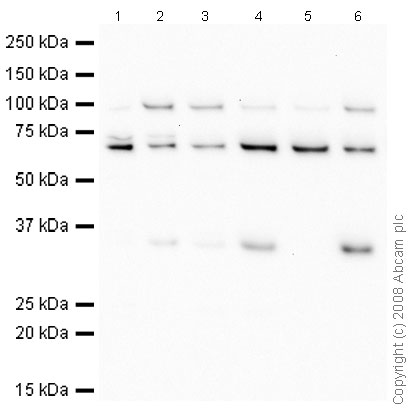 All lanes : Anti-cbx7 antibody - ChIP Grade (ab21873) at 1 µg/mlLane 1 : HeLa (Human epithelial carcinoma cell line) Whole Cell Lysate Lane 2 : HeLa (Human epithelial carcinoma cell line) Nuclear Lysate Lane 3 : Jurkat (Human T cell lymphoblast-like cell line) Whole Cell Lysate Lane 4 : Jurkat (Human T cell lymphoblast-like cell line) Nuclear Lysate (ab14844)Lane 5 : HepG2 (Human hepatocellular liver carcinoma cell line) Whole Cell Lysate Lane 6 : HepG2 (Human hepatocellular liver carcinoma cell line) Nuclear Lysate (ab14660)Lysates/proteins at 10 µg per lane.SecondaryGoat Polyclonal to rabbit IgG - H&L - Pre adsorbed (HRP) at 1/3000 dilutionPerformed under reducing conditions.