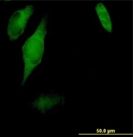 Immunofluorescence of ab68302 staining on HeLa cell at a concentration of 10 ug/ml.