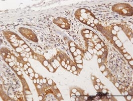Immunoperoxidase of ab68302 on formalin-fixed paraffin-embedded human small intestine. Antibody concentration, 3 ug/ml.