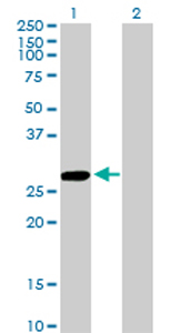 All lanes : Anti-CCBL1 antibody (ab76963) at 5 µg/mlLane 1 : CCBL1 transfected 293T cell lysateLane 2 : Non transfected 293T cell lysateLysates/proteins at 25 µg per lane.SecondaryGoat anti-mouse IgG (H&L)-HRP conjugate at 1/2500 dilution