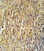Immunohistochemistry analysis of formalin-fixed and paraffin-embedded Human spleen tissue labeling CCDC106 using ab174943 at a 1/50 followed by peroxidase conjugation of the secondary antibody and DAB staining.