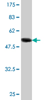 Anti-14-3-3 sigma antibody (ab89510) at 5 µg/ml + Tagged recombinant Human 14-3-3 sigma protein at 0.2 µg