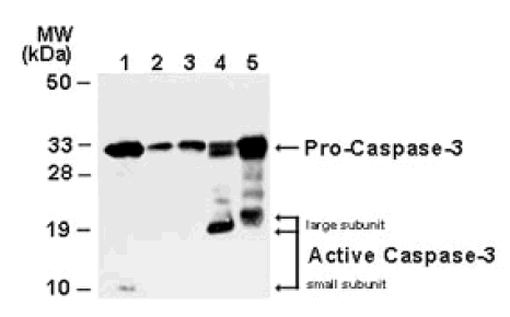 All lanes : Anti-active + pro Caspase 3 antibody (ab47131) at 1/1000 dilutionLane 1 : Lysates from Jurkat cells, total protein content (50 ug/lane)Lane 2 : Normal mammary tissue, total protein content (50 ug/lane)Lane 3 : Surgical specimens from one invasive ductal carcinomas, total protein content (50 ug/lane)Lane 4 : Surgical specimens from one invasive ductal carcinomas, total protein content (50 ug/lane)Lane 5 : Surgical specimens from one invasive ductal carcinomas, total protein content (50 ug/lane)