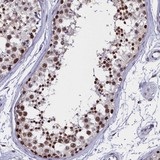 ab130452, at a dilution of 1/50, staining CCDC97 in paraffin-embedded Human testis tissue by Immunohistochemistry.