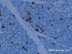 ab2302 at a 1/20 dilution staining active caspase-3 from rat pancreas tissue sections by IHC-P. Heat mediated antigen retrieval was used and the tissue was formaldehyde fixed and blocked with 20% serum. The primary antibody was then incubated with the tissue for 30 minutes. A HRP conjugated goat polyclonal was used as the secondary antibody.See Abreview