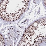 ab130453, at a dilution of 1/500, staining CCDC97 in paraffin-embedded Human testis tissue by Immunohistochemistry.